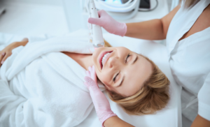 microneedling cape town specials