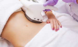 Lipo Laser session from Go Laser