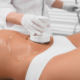 i-spa slimming aesthetics musgrave durban fat loss treatment fat freeze cavitation ultrasound lazer lipo