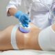 an ultrasound cavitation session from gaia wellness