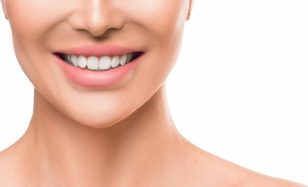 A teethi whitening session from Bella Vida