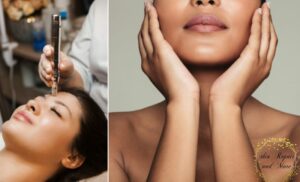 micro-needling Port Elizabeth spa Skin Repair and More