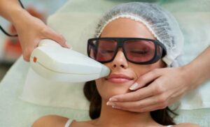 laser hair removal in a small area at zola aesthetics and laser