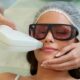 laser hair removal in a small area at zola aesthetics and laser