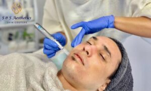 microneedling session Cape Town spa S&S Aesthetics