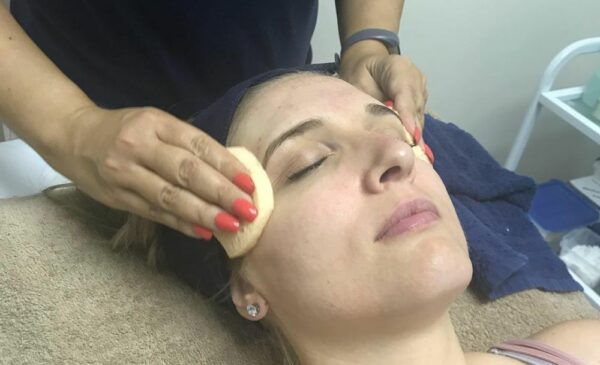 A woman receiving a chemical peel at Aesthetic Beauty Corner in Lone Hill