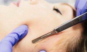 A 45-Minute Dermaplaning Session in Sea Point