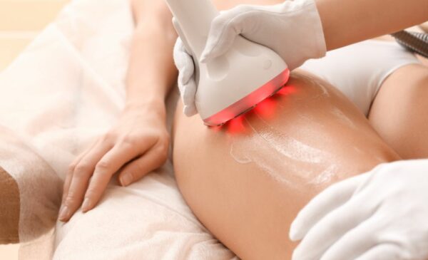 A Cold Lipo Laser Session in Bellville