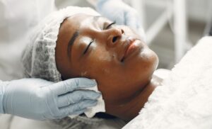 A Chemical Peel or an Acne/Pigmentation Facial in Fourways