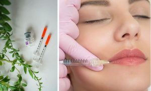 Lip Filler and a Brightening Peel in Durban North