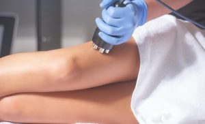 Fat-Freezing and Cavitation in Oakdale