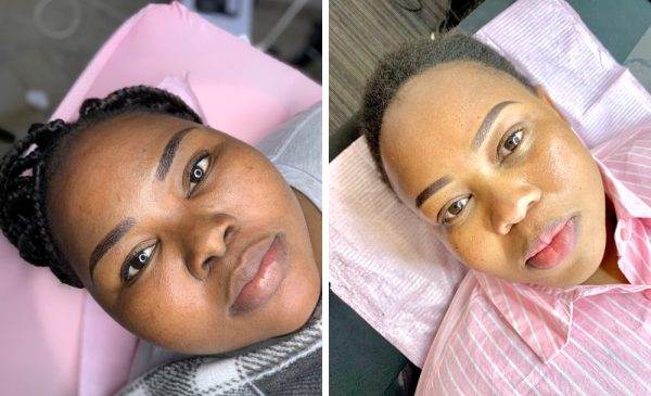 A collage of two women after their microblading session at Dermaskin Aesthetics in Sandton