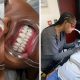 A woman having a teeth-whitening session done at Dermaskin Aesthetics in Fourways