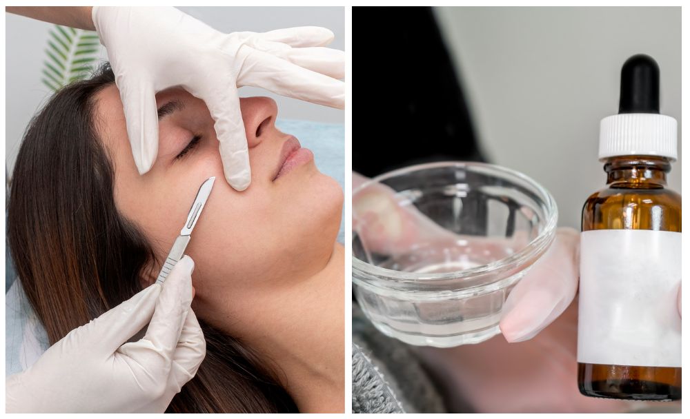 Dermaplaning and a Chemical Peel in Umhlanga