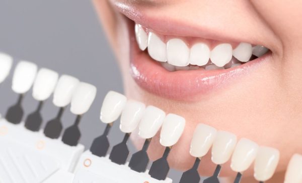 A 30-Minute Teeth Whitening Treatment in Wonderboom