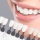 A 30-Minute Teeth Whitening Treatment in Wonderboom