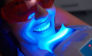 Get A Teeth Whitening Treatment in Sea Point