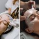A collage of stock photos of a woman getting a chemical peel and a woman having microneedling done