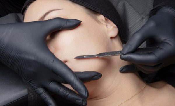A stock photo of a woman during dermaplaning at the spa