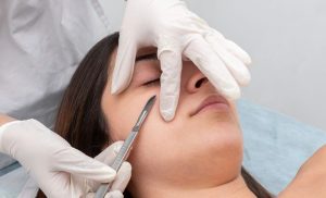 An Express Facial and Dermaplaning in Durban North