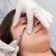 An Express Facial and Dermaplaning in Durban North