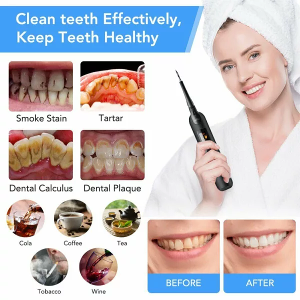 USB Rechargeable Electric Dental Calculus Tooth Cleaner with LED HD Screen_4