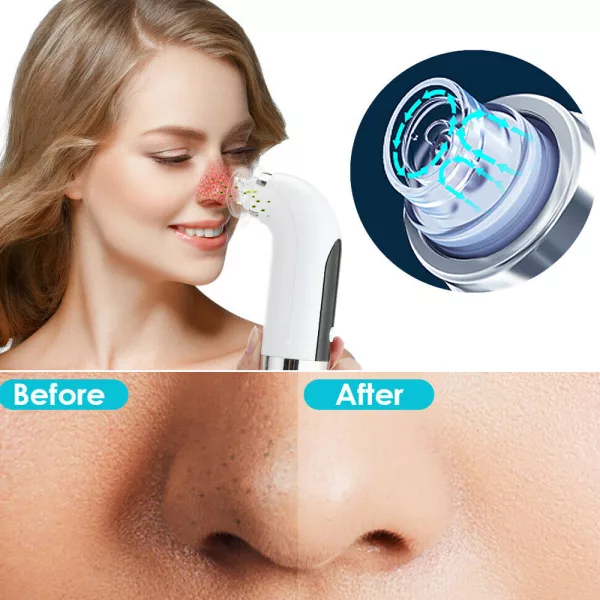 USB Rechargeable Electric Pore Blackhead Vacuum Cleaner_8