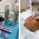 A Chemical Peel and Microneedling Combo in Randburg