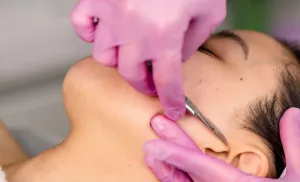 A Dermaplaning Facial with a Choice of a Massage in Umhlanga