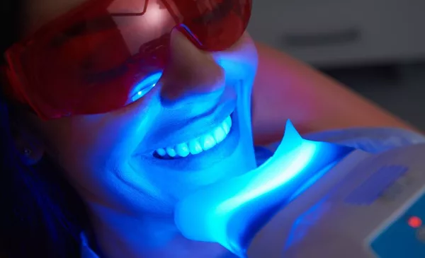 teeth whitening