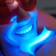 teeth whitening