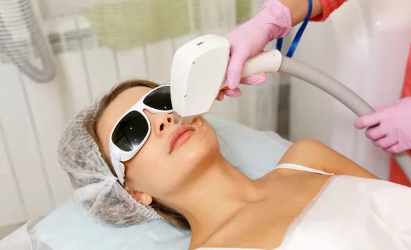 4 Sessions of Full-Face Laser Hair Removal in Boksburg