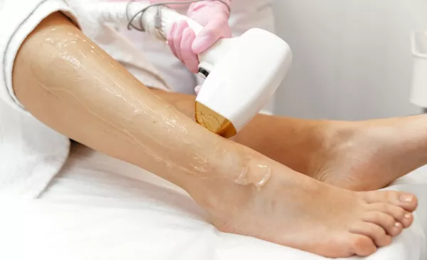 A Laser Hair Removal Session in Norwood