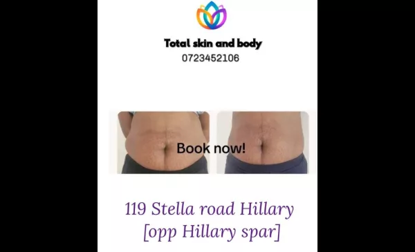 Faradic slimming treatment