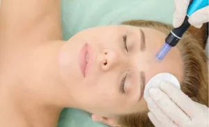 face microneedling