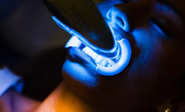 A Zoom Teeth Whitening Treatment in Claremont