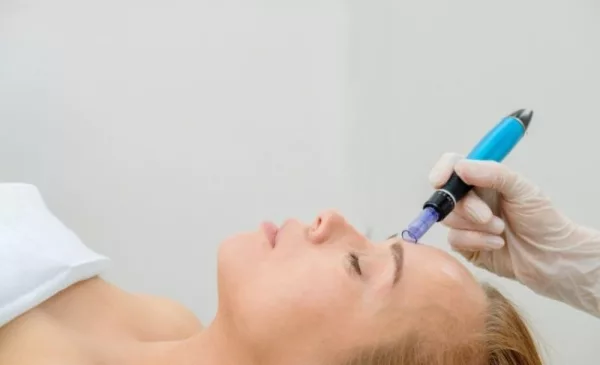 Microneedling with a Facial in Tygervalley