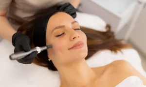 microneedling